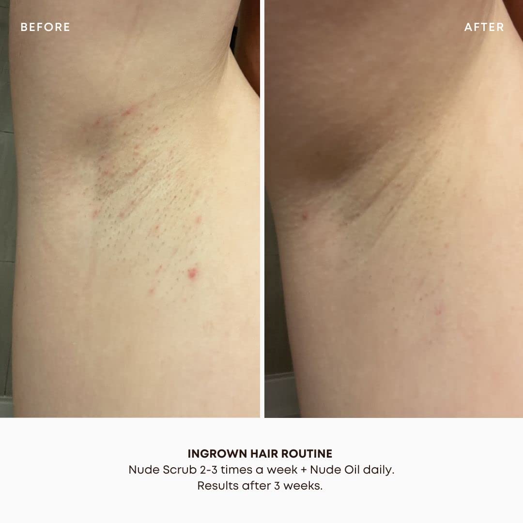 Bushbalm Ingrown Hair And Razor Bumps 2 Step Routine - Moisturize And Soothe - Nude Ingrown Hair Oil (30 Ml), Nude Exfoliating Scrub (236 Ml) - Nude : Beauty & Personal Care