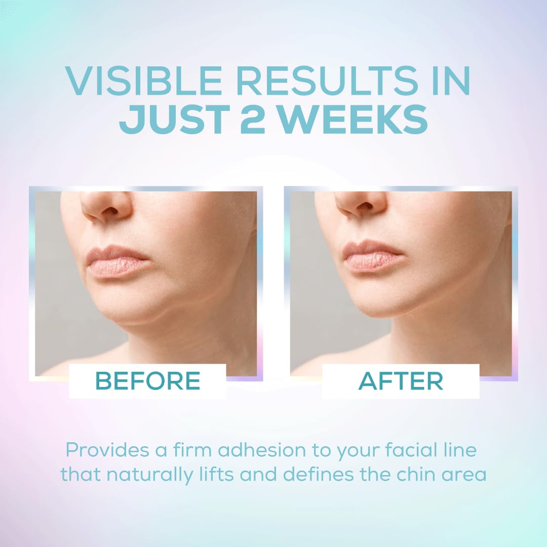Venus Visage V Line Lifting Mask - Invisible Face Strap - Chin Strap For Double Chin For Women And Men - Firming Double Chin Strap For Defined Jawline (5 Count, 1 Pack) : Beauty & Personal Care