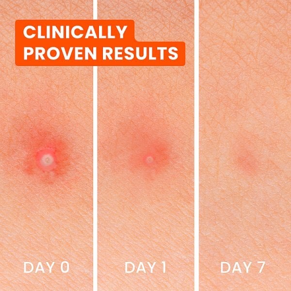 Biore Spot Control Patch - Azelaic And Tranexamic Acid Patch