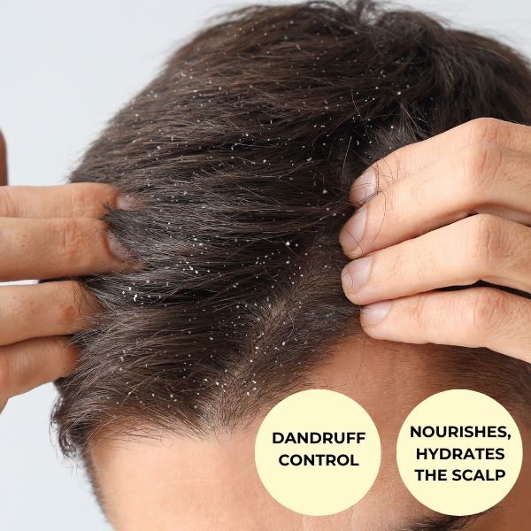 Ayumi Bio-Active Anti-Dandruff Scalp Oil 150Ml