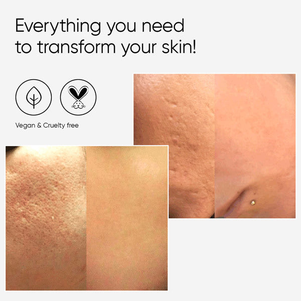 Âme Pure Cit Face Roller Basic 0.5Mm