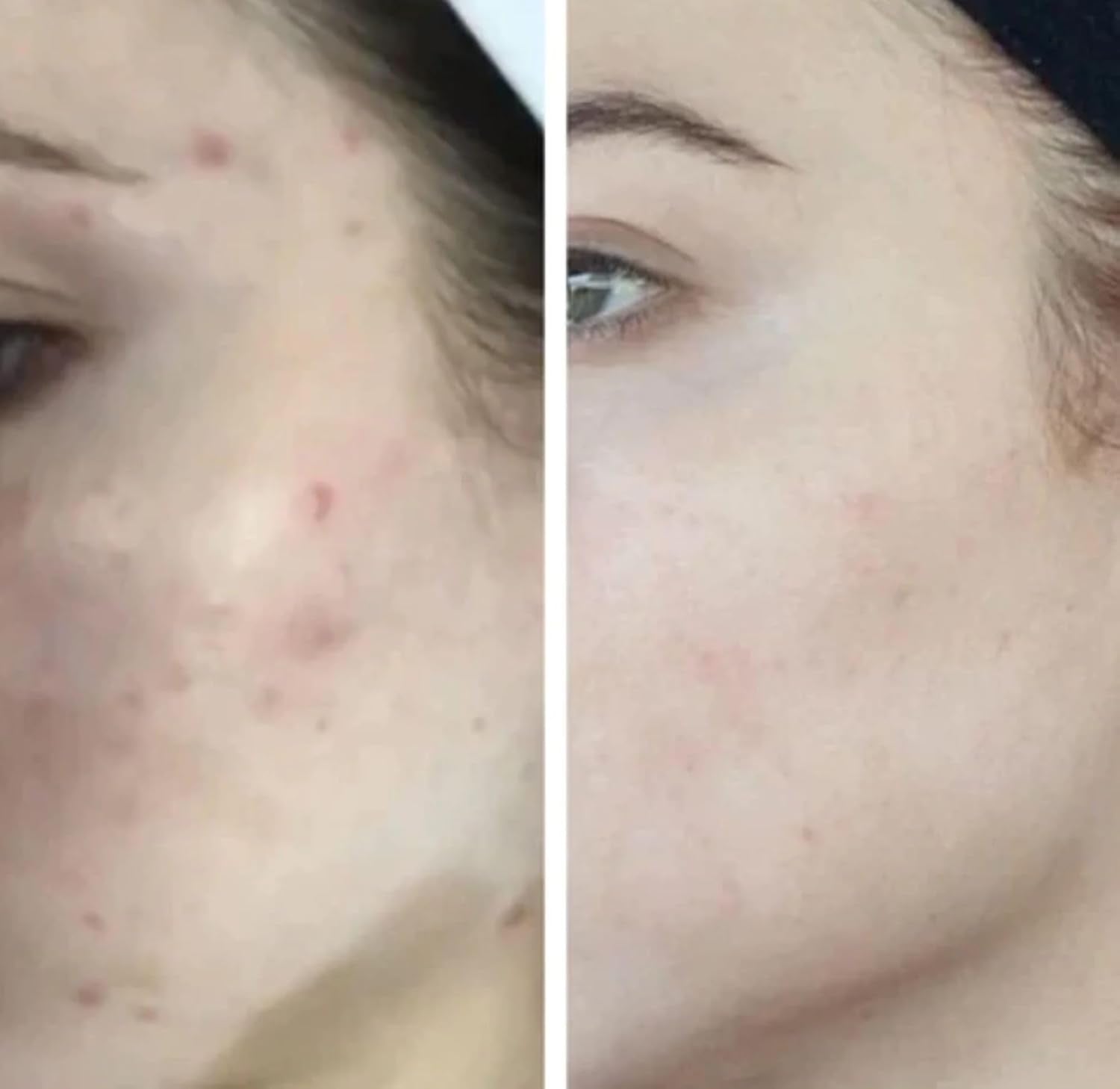 Higherdose Light-Activated Glow Serum - Anti Aging Face Serum To Plump, Hydrate & Smooth Fine Lines - Made With Vitamin C, Copper Peptides & Hyaluronic Acid - Boosts Benefits Of Red Light (1 Oz) : Beauty & Personal Care