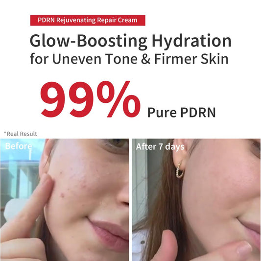 Pdrn Rejuvenating Repair Cream, 99.9% Pure Salmon (Sodium Dna), Bakuchiol, Cica Exosome, Niacinamide, Aging Care, Wrinkle Care, Intensive Glow, Skin Elasticity, 40Ml 1.35 Fl Oz
