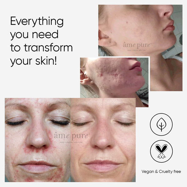 Âme Pure Cit Face Roller Platinum 0.5Mm