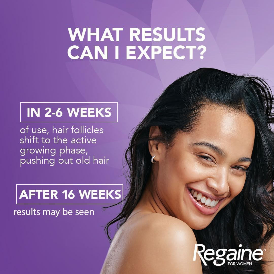 Regaine for Women 2% Minoxidil Regular Strength Scalp Solution for Hair Regrowth (1x 60 ml), Scientifically Proven to Help Stop and Reverse Hereditary Female Hair Loss, Revitalise Hair Follicles : Amazon.co.uk: Beauty