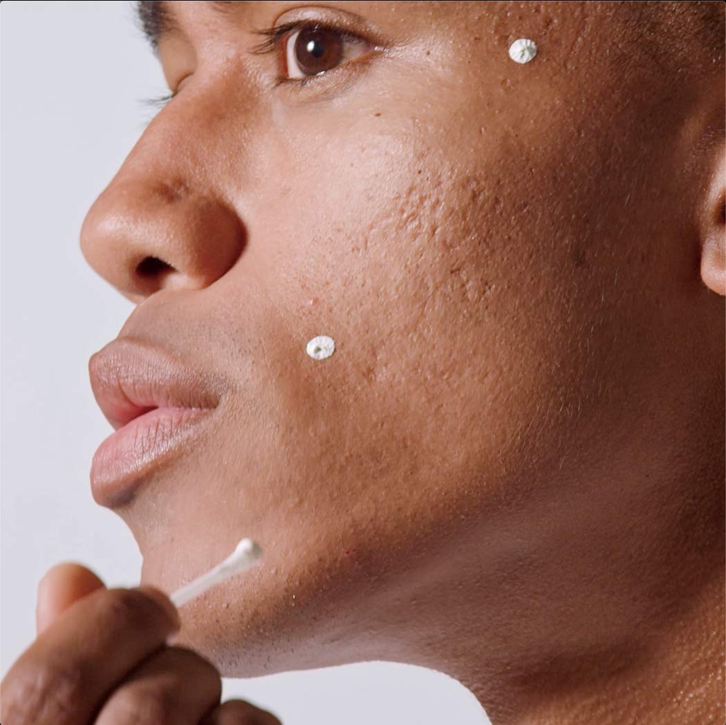 Malin + Goetz Acne Treatment Nighttime, 0.5 Fl. Oz. - Overnight Sulfur Acne Spot Treatment, Blemish Control & Scar Treatment, All Skin Types, Vegan & Cruelty Free : Beauty & Personal Care