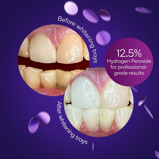 Burst Sensitive Teeth Friendly Whitening Kit | 7 Treatments With 12.5% Hydrogen Peroxide | Results In 15 Min. + Up To 6 Shades Whiter In 1 Week | Prefilled Gel Trays