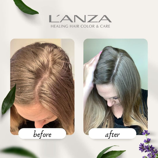 L'Anza Healing Remedy Scalp Balancing Cleanser, Restores Wellness To Hair And Scalp While Reducing Oiliness And Excessive Sebum, With Papaya Extract, Paraben-Free, Gluten-Free (9 Fl Oz)