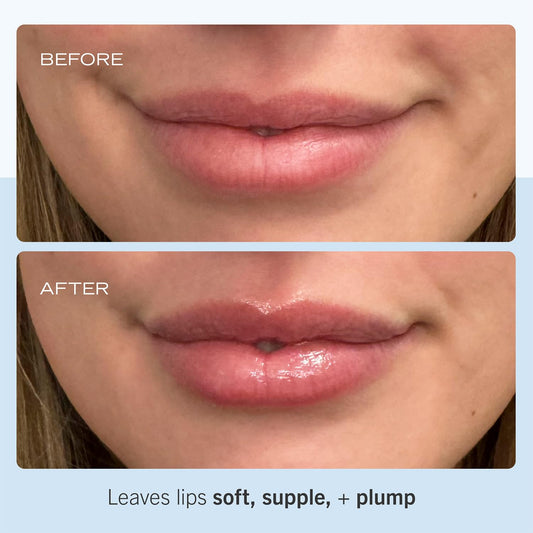 First Aid Beauty Ultra Repair Lip Balm – Instantly Hydrates To Leave Lips Soft, Supple + Plump – Concentrated Formula Of Botanical Oils, Butters + Waxes – 0.25 Oz