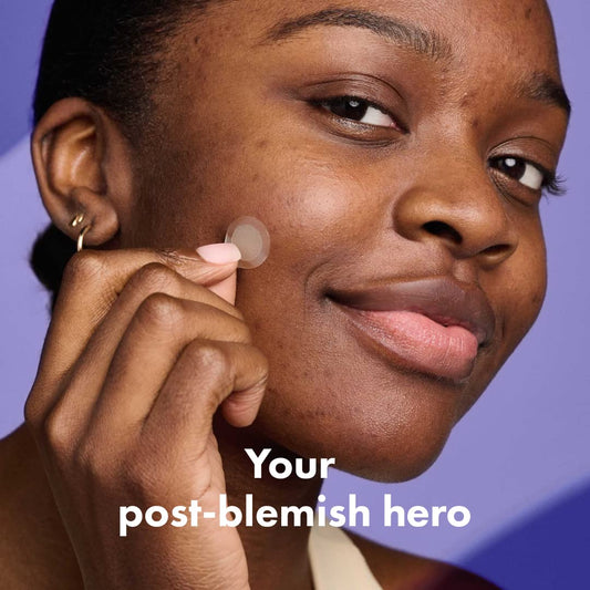 Hero Cosmetics Mighty Patch Micropoint™ For Dark Spots - Post-Blemish Dark Spot Patch With 395 Micropoints, Dermatologist Tested And Non-Irritating (8 Count)