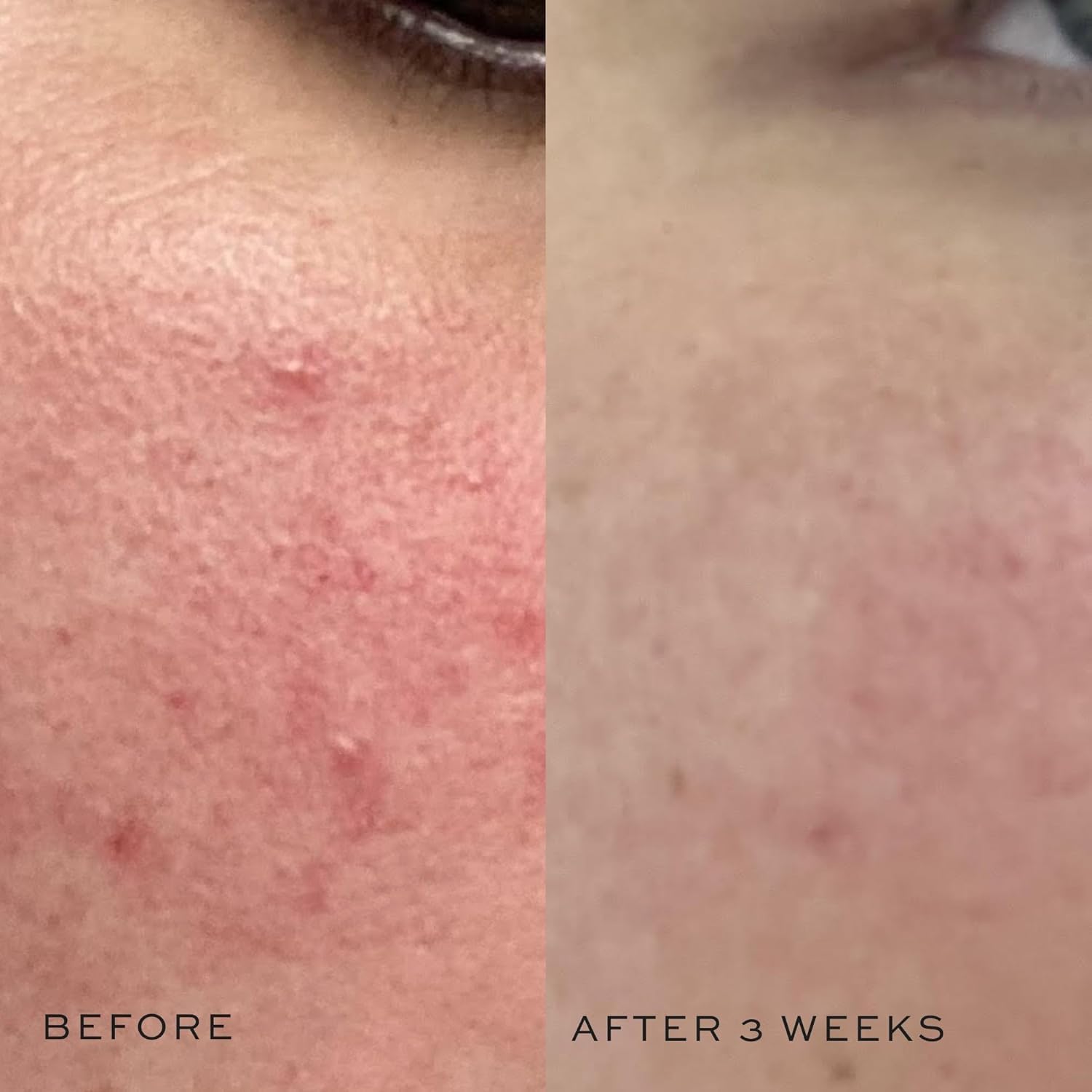 Dime Beauty Super Skin Toner, Alcohol-Free Witch Hazel Toner, Hydrating For Face With Aloe Vera And Cucumber Extract, 4 Oz / 120 Ml : Beauty & Personal Care