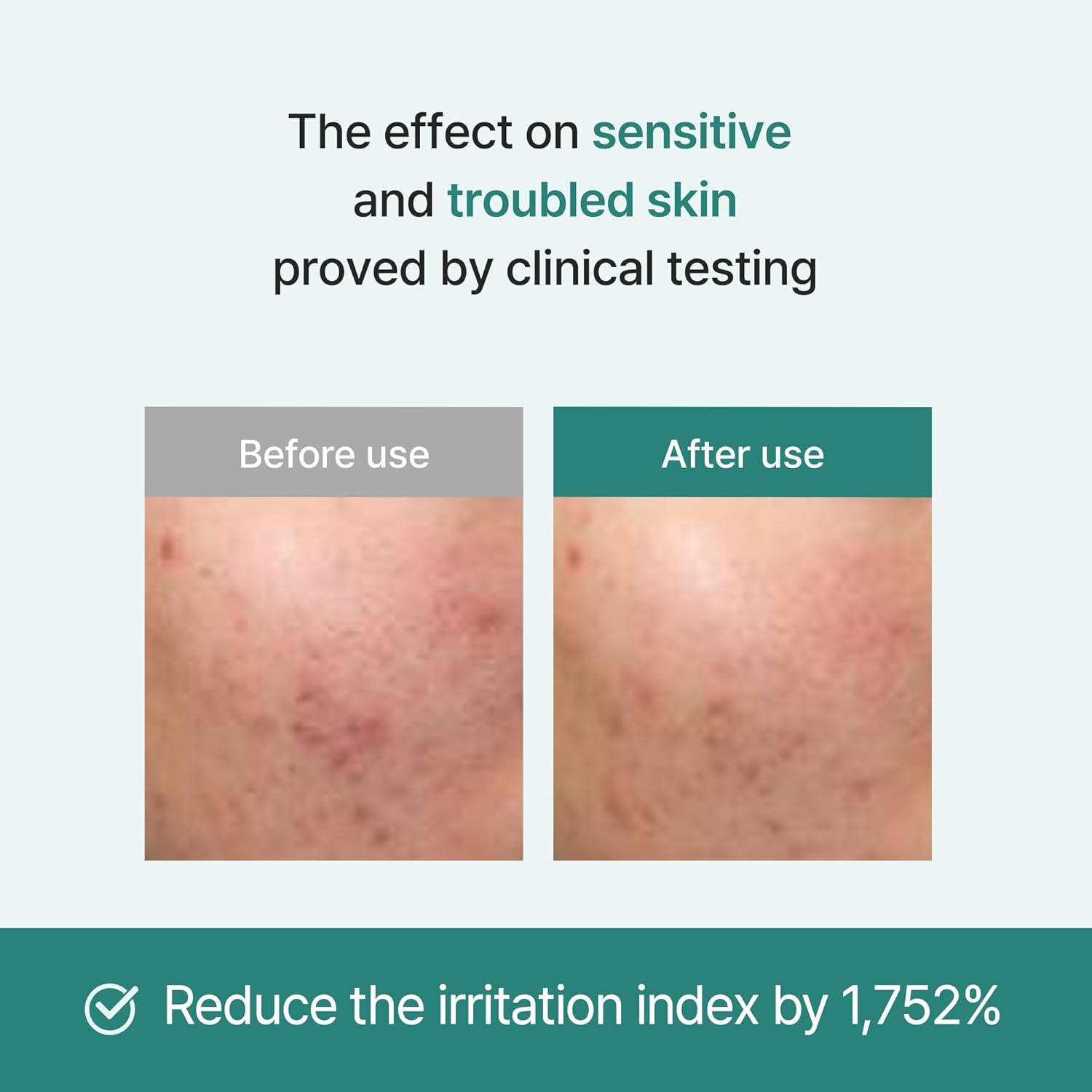I'M From Licorice Soothing Ampoule, 73% Korean Licorice, Exosome, Non-Comedogenic 1.01 Fl Oz : Beauty & Personal Care