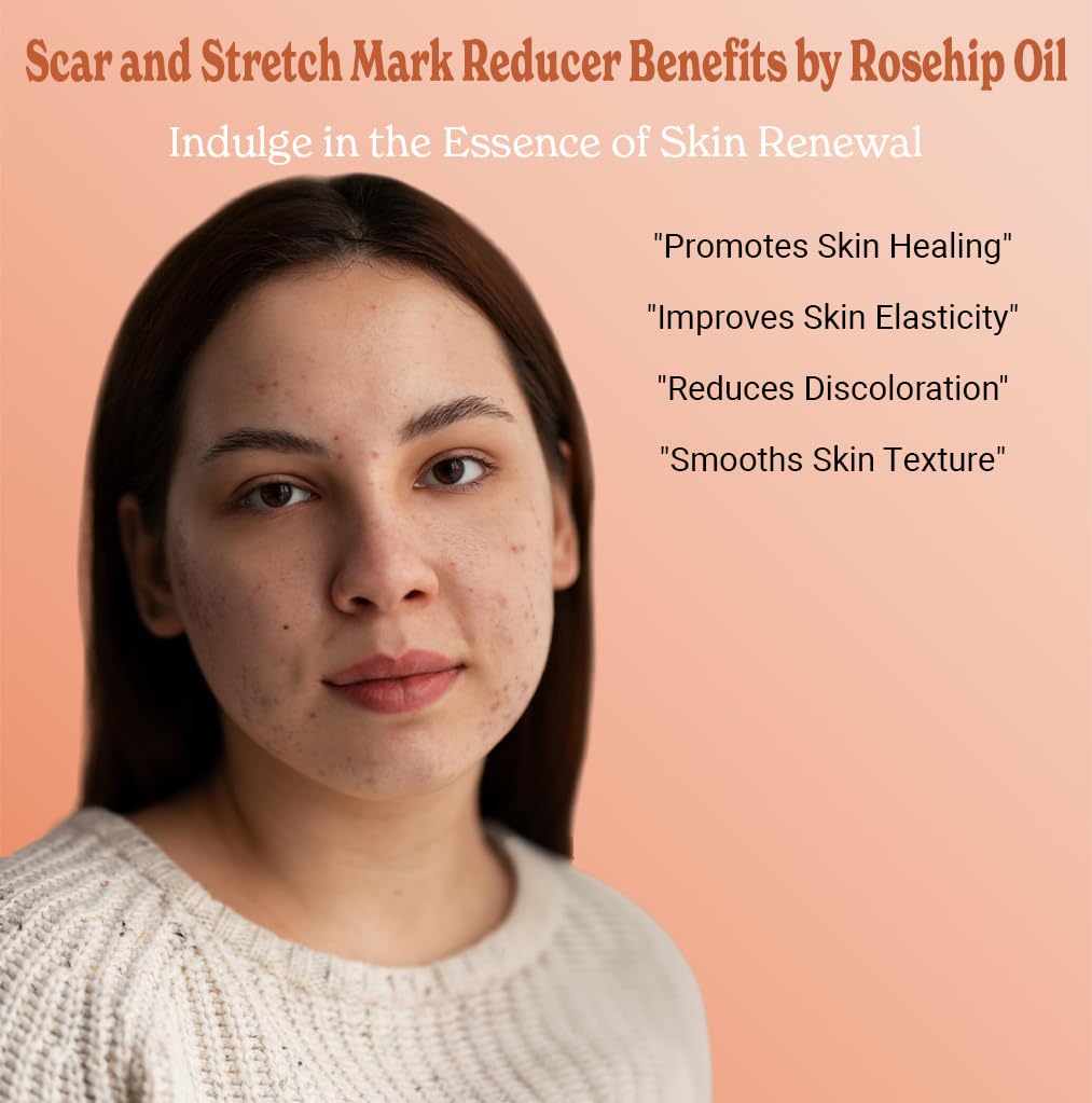 Bella Terra Oils - Organic Rosehip Oil 4 oz - Hailing from the Finest Rosa Mosqueta, Abundant in Omega-6 & Omega-3 Fatty Acids, Pure Radiance for Face : Beauty & Personal Care