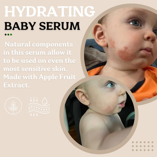 Roe Wellness- Baby Serum Skincare Probiotic Protection | Hydrating, Soothing, Clean Ingredients & Safe For All Skin Babies, Infants, Toddlers & Kids (Power Serum)