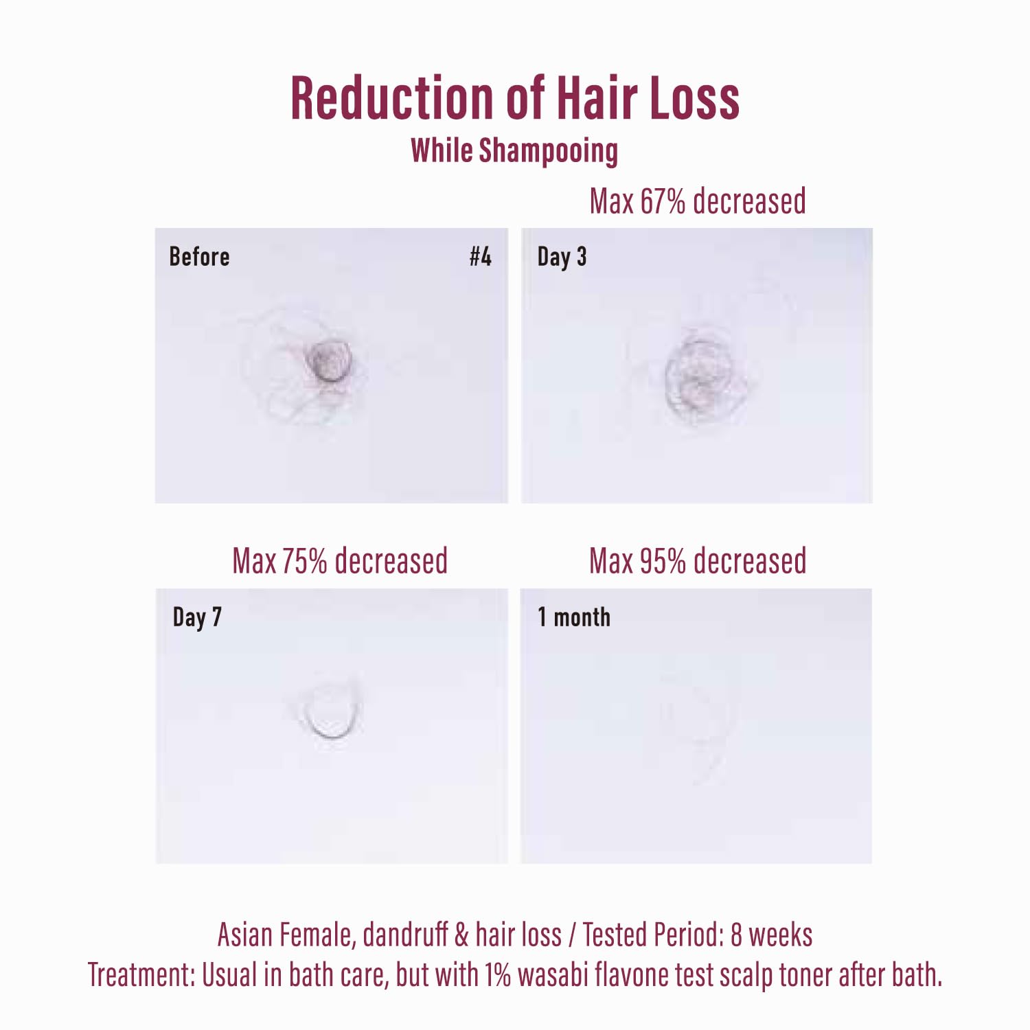 Moist Diane Thicker Fuller Hair Serum, Anti Hair Loss Serum & Hair Treatment For Women & Men By Salicylic Acid, Keratin, Ginseng& Argan Oil, Hair Thickening Serum From Japan 1.69Fl Oz Hair Fall : Beauty & Personal Care