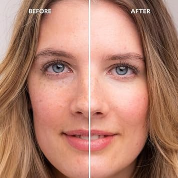 Gatineau - Miracle Eye Contour Cream, Conceal Dark Circles, Hydrating with Hyaluronic Acid & Vitamin E (11ml x 2) : Amazon.co.uk: Beauty