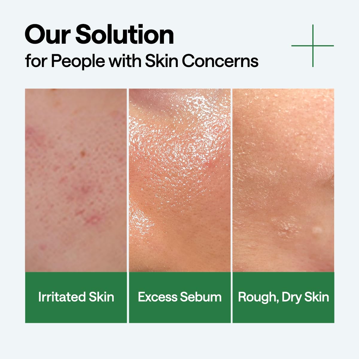 Mediheal Teatree Calming Serum 1.35 Fl.Oz - Quick Skin Calming And Redness Relief - Sebum Care, Oil Moisture Balance & Deep Moisturization With Hyaluronic Acid : Beauty & Personal Care