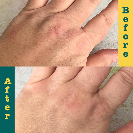 Soothing Ointment W/Turmeric & Calendula: Ultra-Moisturizing Barrier Cream For Dry, Chapped Skin On Your Body, Face, Or Lips, 3 Oz