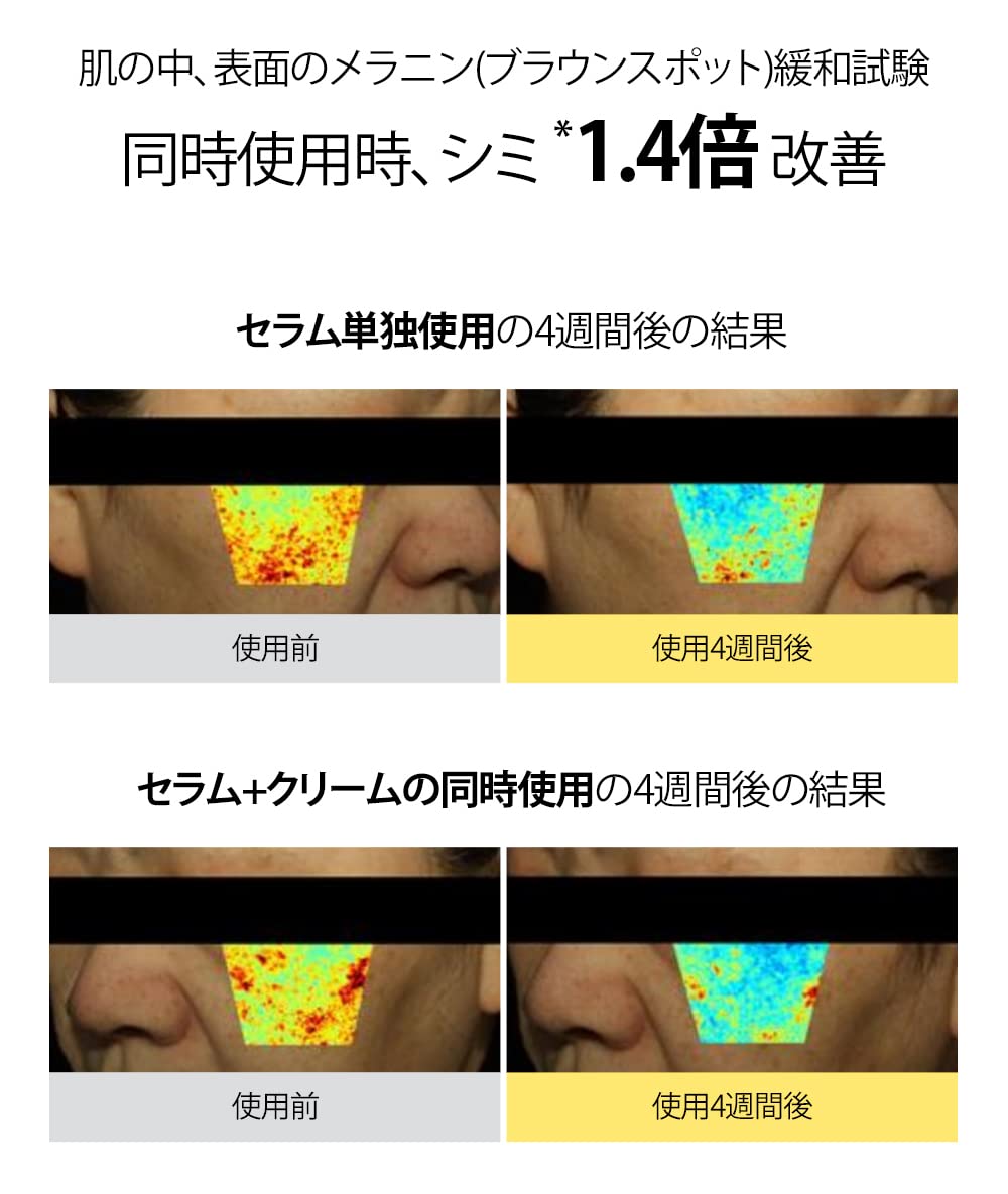 Goodal Green Tangerine Vitamin C Serum (Old Version) : Beauty & Personal Care