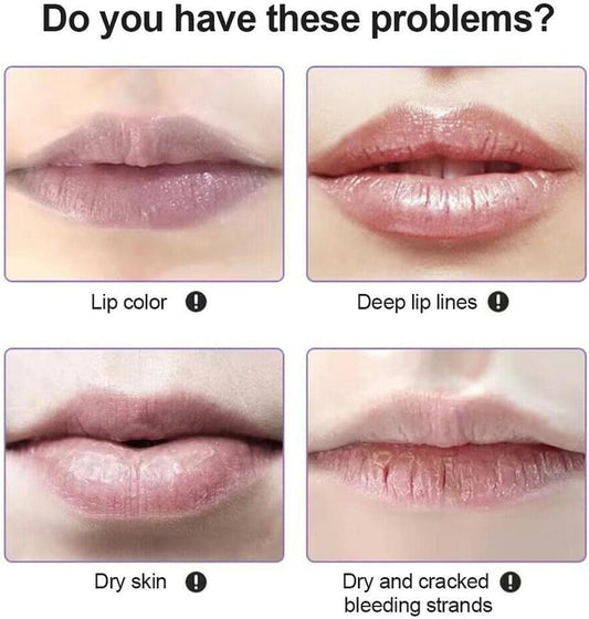 Honey Lip Mask, Moisturizing And Repairing Lip Sleeping Mask, Repair The Lip Color Fade Lip Lines Hydrating Prevention Dry,Sleeping Lip Mask Lip Oil Honey Lip Balm