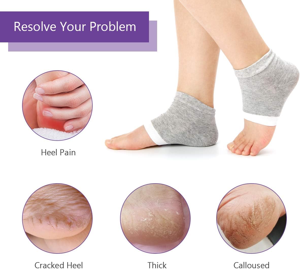 4 Pairs Heel Moisturizing Socks, Spa Lotion Gel Socks for Dry Cracked Heels, Open Toe Socks for Men and Women for Heal, Treat Dry While You Sleeping