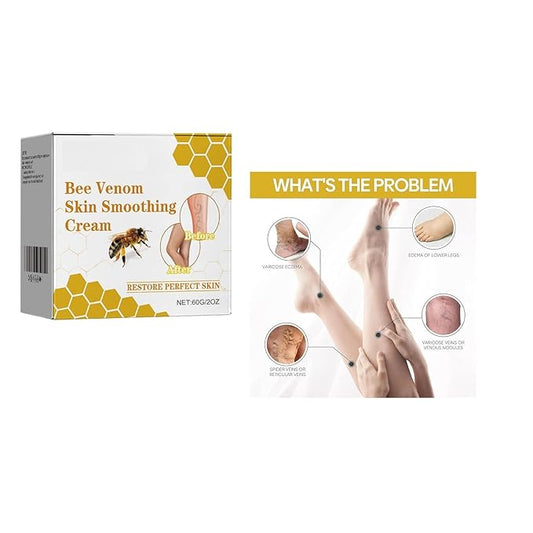 Bee Venom Varicose Veins Cream – Natural Pain Relief & Soothing Ointment for Legs, 50ml