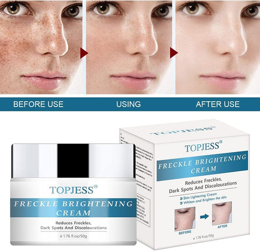 Hope'S Relief Derma-Lotion For Dry Skin Cream For Dermatitis Treatment, Ezema And Psoriasis Ultra-Lightweight