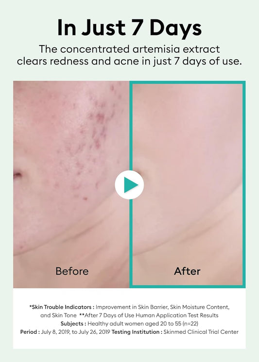 Missha Artemisia Calming Ampoule 1.69 Fl Oz / 50Ml - Face Serum For Sensitive Skin, Korean Skin Care With Double-Fermented Mugwort Extract, Soothes Redness, Acne & Irritation