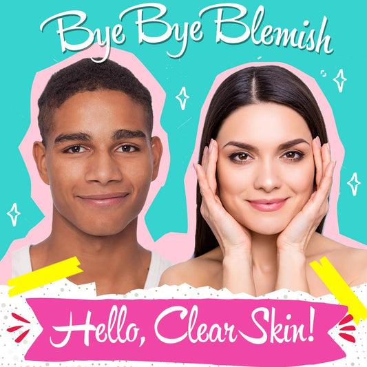 Bye Bye Blemish Drying Lotion Volcanic Ash | Acne Drying Solution To Assist With Blemish Prevention | 1 Fl. Oz