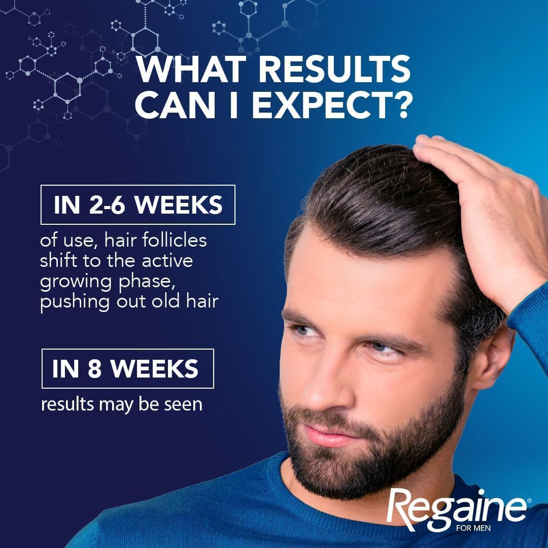 Regaine for Men 5% Minoxidil Extra Strength Scalp Solution for Hair Regrowth (1x 60ml), Scientifically Proven to Help Stop and Reverse Hereditary Hair Loss, Revitalise Hair Follicles : Amazon.co.uk: Beauty