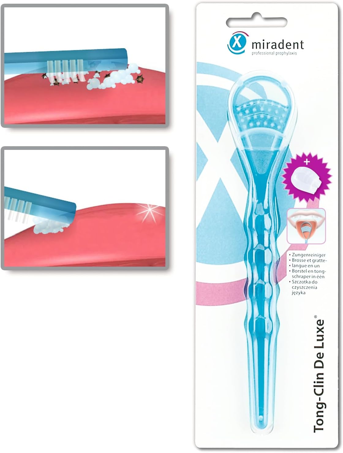 Miradent Tongue Cleaner Tong Clin De Luxe, Blue, Pack of 1 : Amazon.co.uk: Health & Personal Care