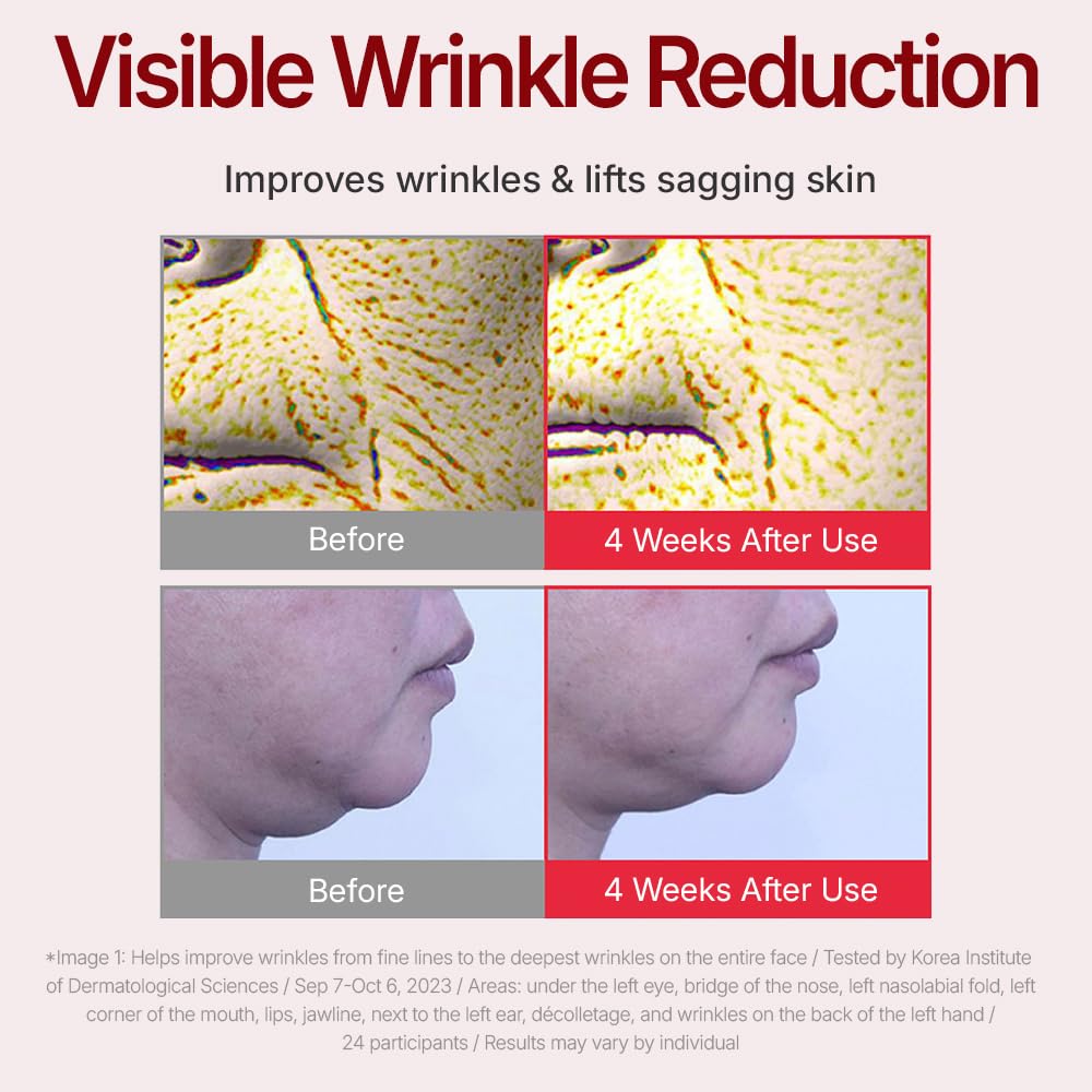 Centellian 24 Madeca Cream (Season 4, 1.7+1.7Fl Oz) - Centella Moisturizer For Face, Korean Skin Care. Dry, Sensitive Skin. Teca, Centella Asiatica, Madecassoside : Beauty & Personal Care