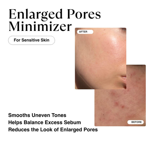 Matkas Korean Niacinamide Serum For Face Antioxidant Ampoule - For Excess Oil, Large Pores, Uneven Skin Tone, Dullness - Centella Asiatica + Ceramides + Vitamin E + Hyaluronic Acid + Beta-Glucan