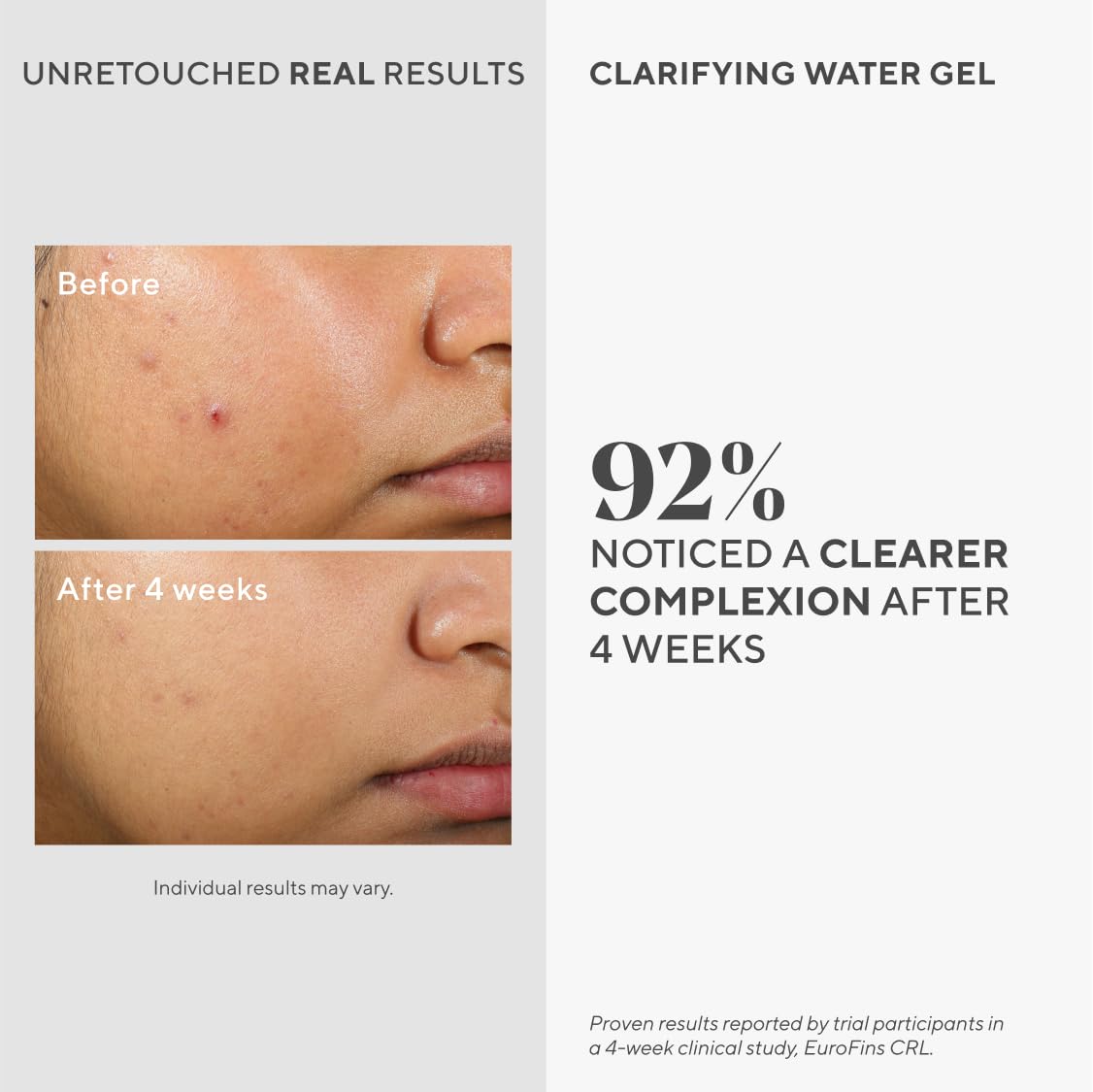 Murad Clarifying Water Gel - Non-Comedogenic Light Gel Moisturizer For Face, Neck & Chest - Facial Skin Care Product Hydrates With Non-Greasy Finish, 2 Fl Oz : Beauty & Personal Care