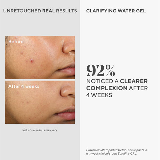 Murad Clarifying Water Gel - Non-Comedogenic Light Gel Moisturizer For Face, Neck & Chest - Facial Skin Care Product Hydrates With Non-Greasy Finish, 2 Fl Oz : Beauty & Personal Care