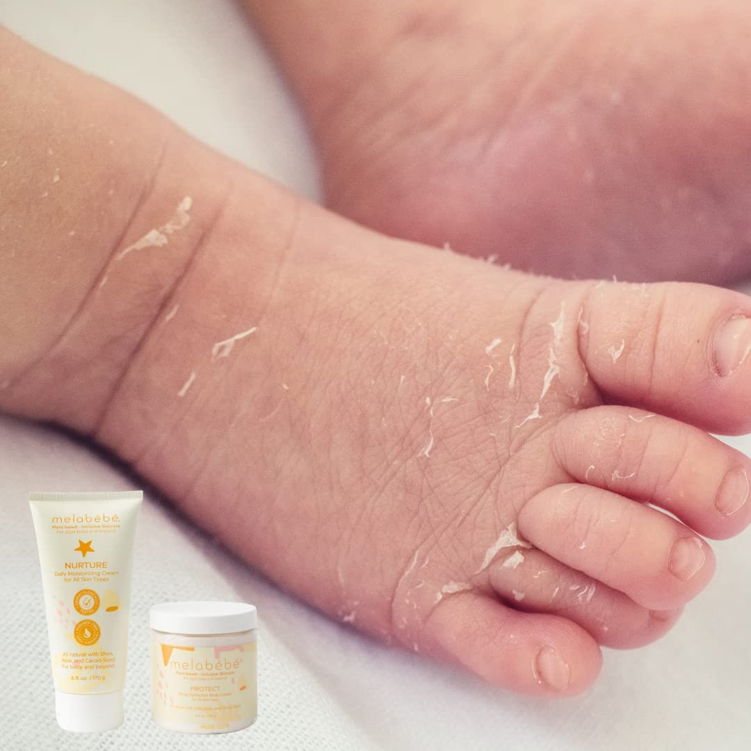 Melabebe Protect: Deep Hydration Body Cream - Baby Moisturizer for Sensitive Skin & Eczema Kids Lotion - Baby Lotion Organic Based Cream w/Aloe Vera, Jojoba Oils & Shea Moisture Baby Lotion - 8oz : Baby
