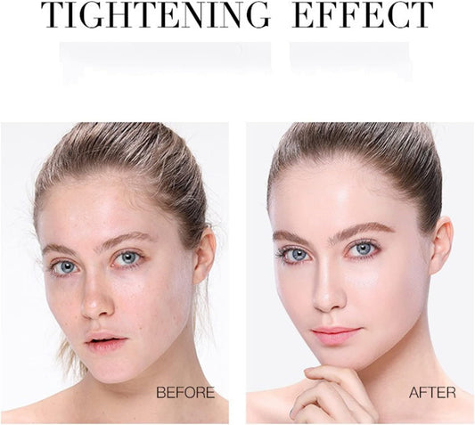 Instalift Protein Thread Lifting Set, Soluble Protein Thread And Nano Gold Essence Combination, Protein Threads Absorbable Collagen Thread For Face Lift, Smoothes Fine Lines (3 Sets+9 Protein Thread)