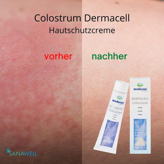 Colostrum DermaCell skin cream 100ml - Natural soothing cream for dry, irritated skin