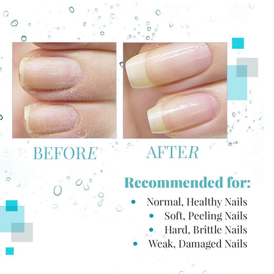 Nail Tek Renew, Natural Cuticle Oil With Tea Tree For All Nail Types, 0.48 Oz, 1-Pack