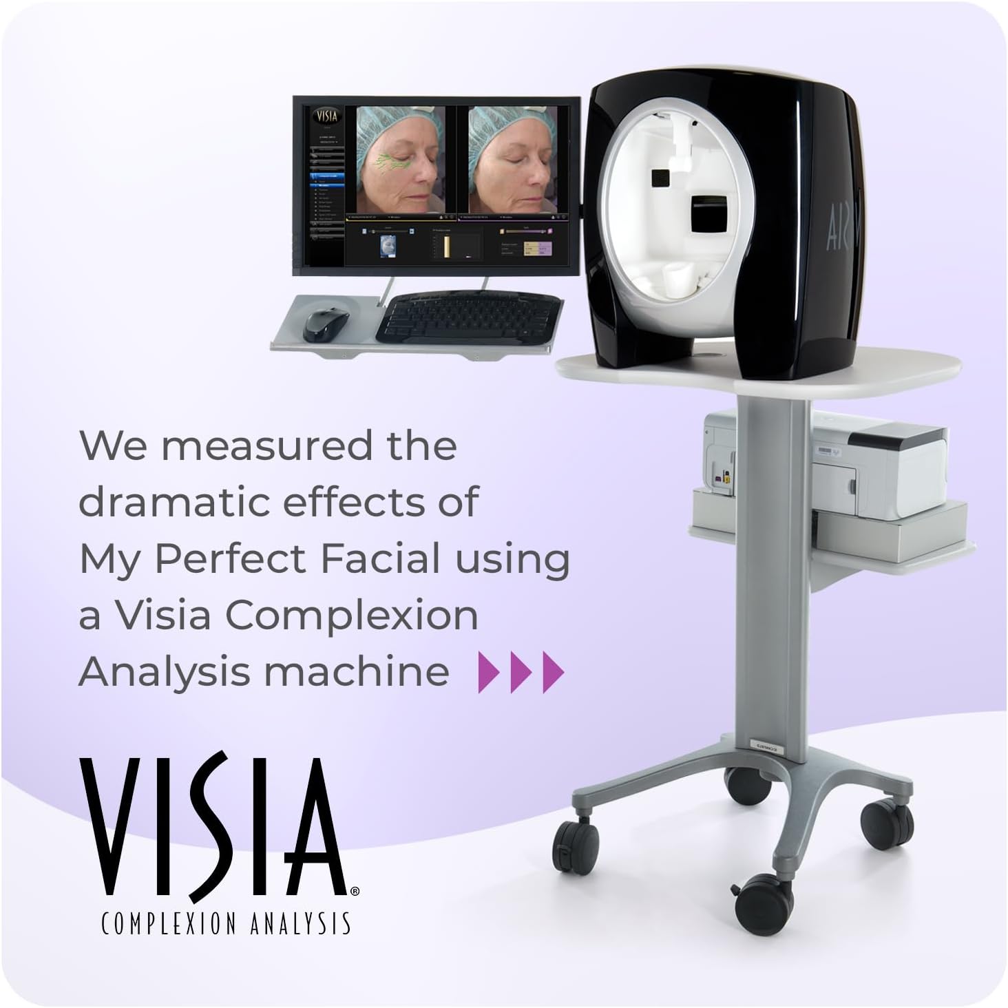 My Perfect Facial, Penny Lane, 5 Treatment Kit, Instant Results, Clinically Proven, Anti-Ageing 3-Stage Facial Contouring and Skin Tightening System. Salon Grade Results, As Seen on TV. : Amazon.co.uk: Beauty