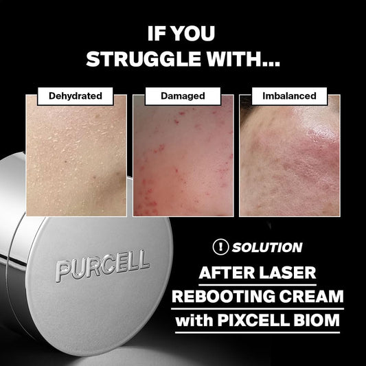 Pixcell Biom™ After Laser Rebooting Cream For Probiotic Barrier Recovery With Niacinamide, Panthenol, Suitable For Sensitive Skin, 1.69 Fl Oz(50Ml)