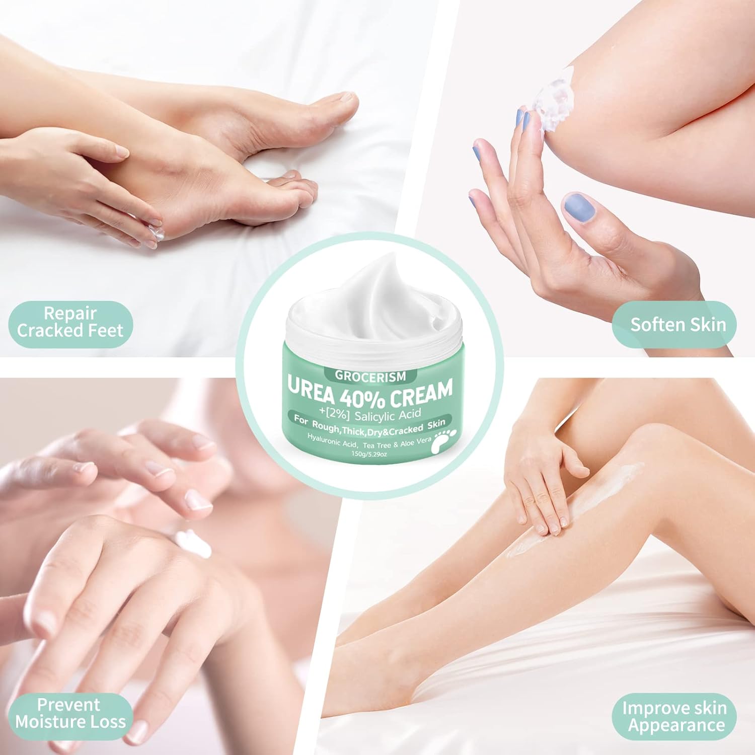 Urea Cream 20 Percent For Feet Plus 2% Salicylic Acid 150G | Foot Cream And Hand Cream Maximum Strength With Hyaluronic Acid, Tea Tree, And Aloe Vera For Deep Moisturizes