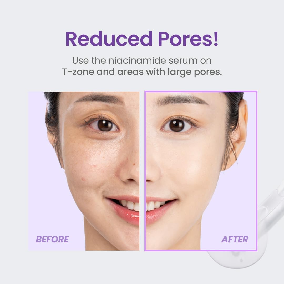 TIRTIR Niacinamide 20% Serum 30ml : Amazon.co.uk: Beauty