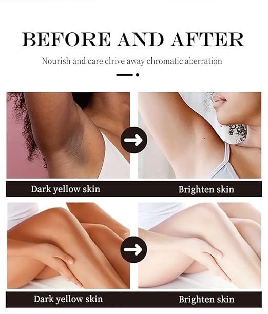 Skin Brightening Cream for Underarms- Knees & Elbows | Moisturizing Care for Uneven Tone