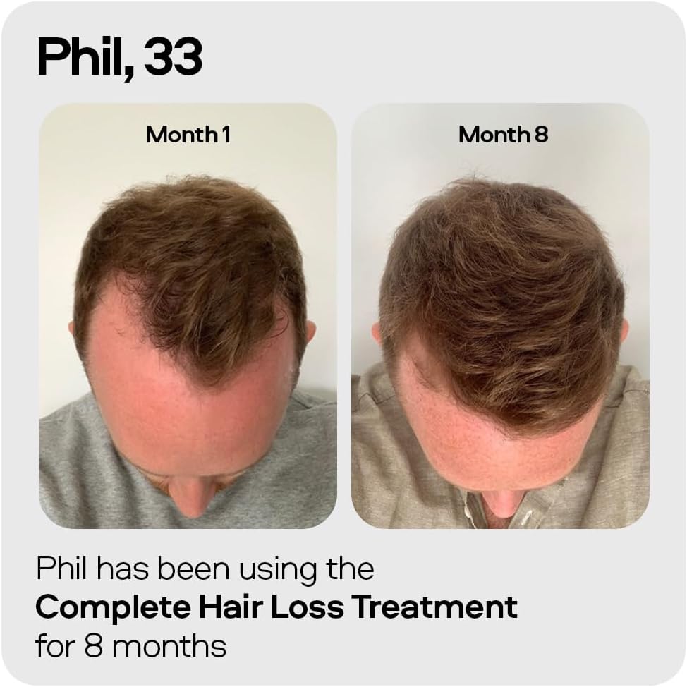 Sons Hair Growth Shampoo For Men. DHT Blocker. Thickening Formula Promotes Strong & Thick Regrowth. Contains Saw Palmetto, Argan Oil, Caffeine, & Rosemary. 1 Month Supply. Made in Europe. : Amazon.co.uk: Beauty