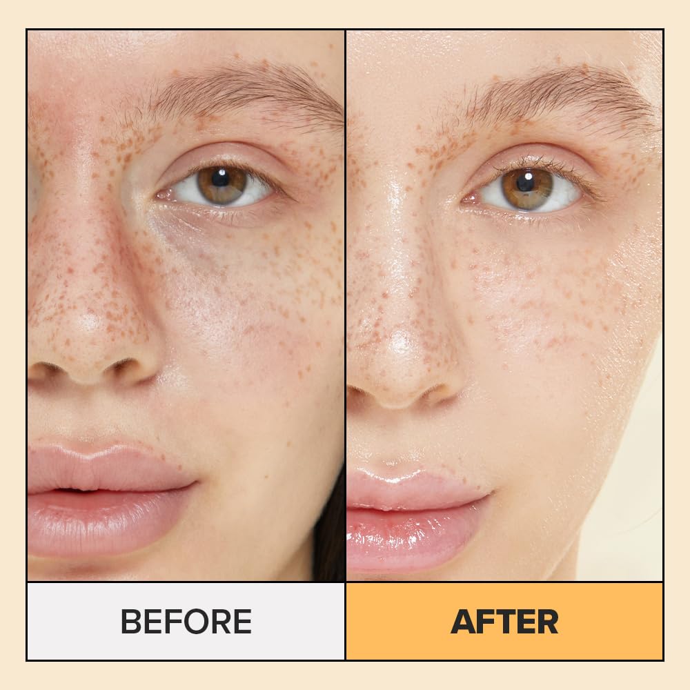 I Dew Care Real Herb Calendula Sheet Face Mask - Hot As Sheet | Korean Face Masks Skincare, Moisturizing And Calming For Dry Skin With Calendula Flower Extract, 2% Niacinamide, 10Ea : Beauty & Personal Care