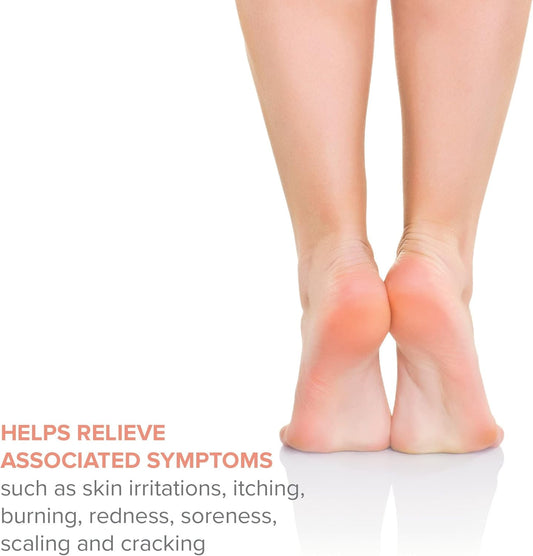 Thera Mckesson’S Antifungal Cream, 2% Miconazole Nitrate, Body, Skin, Athletes Foot Treatment - Relief For Ringworm, Jock Itch - 4 Oz