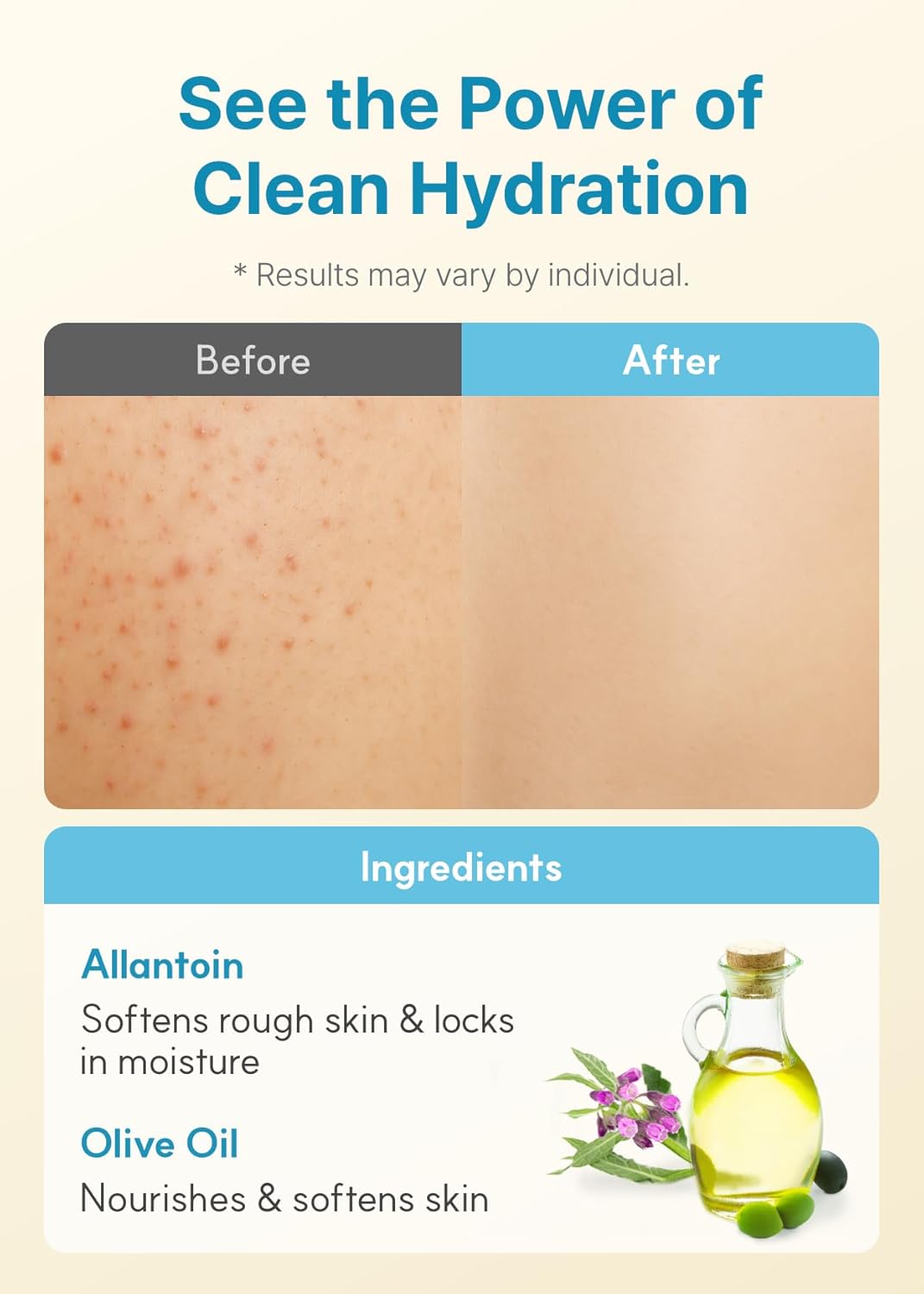 Derma B | Daily Moisture Body Lotion | Body Cream For Dry Skin | Long-Lasting Body Moisturizer For Sensitive Skin | Woody & Powdery Scented | Skincare With Panthenol, Shea Butter | 13.5 Fl Oz (400Ml) : Beauty & Personal Care