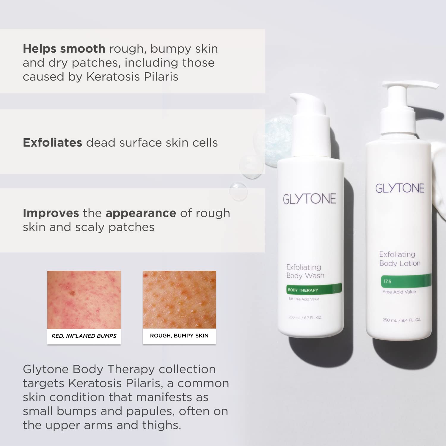 Glytone Glycolic Acid Body Wash – Exfoliating & Moisturizing Body Wash For Dry Skin, Reduce Keratosis Pilaris – Fragrance-Free Exfoliator With Glycolic Acid For Rough & Bumpy Skin, 2 Fl Oz : Beauty & Personal Care