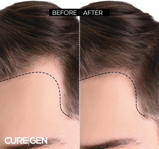 Curegen Biotin Shampoo For Hair Growth And Thinning Hair – Thickening Formula For Hair Loss Treatment – For Men & Women